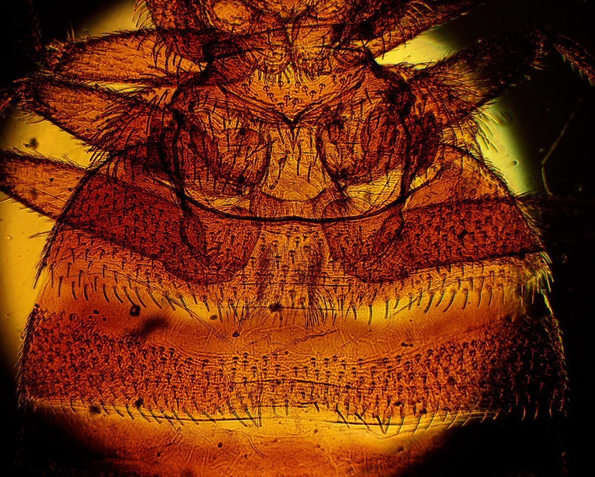 Common Bed Bug (Cimex Lectularius) Under High Magnification