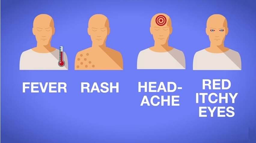 Zika symptoms