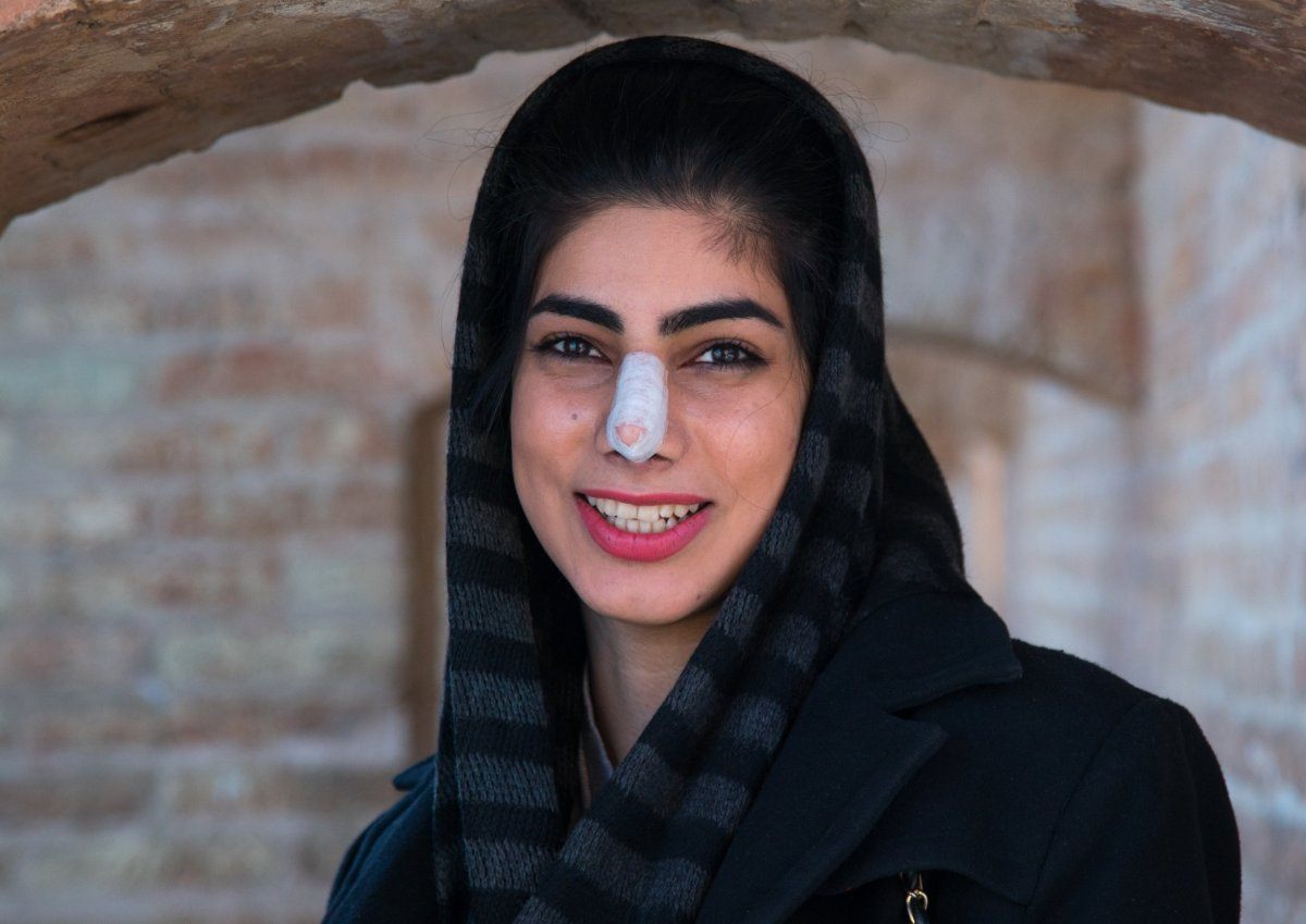 Iranian woman with nose job