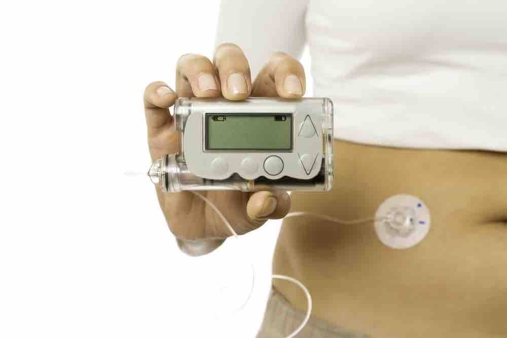 insulin pump